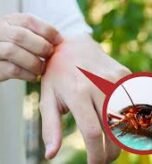 do roaches bite